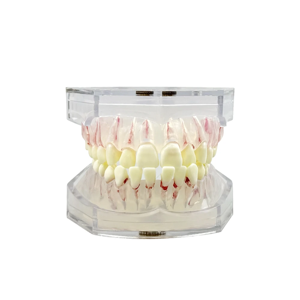 

Dental Transparent Removable Root Canal Dental Model Dental Implant Restoration Pathological Model Dental Teaching Demonstration