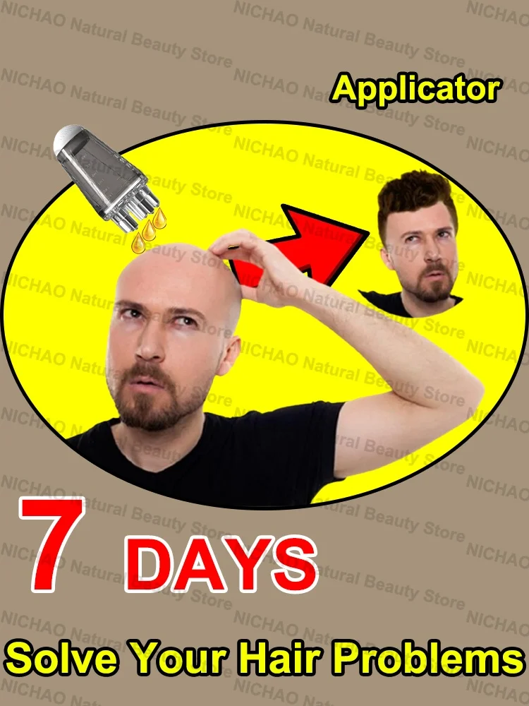 

7-дневное быстрое лечение роста волос, необходимое лечение от роста волос, укрепляет волосы, питает кожу головы, легкий вес, нежирный