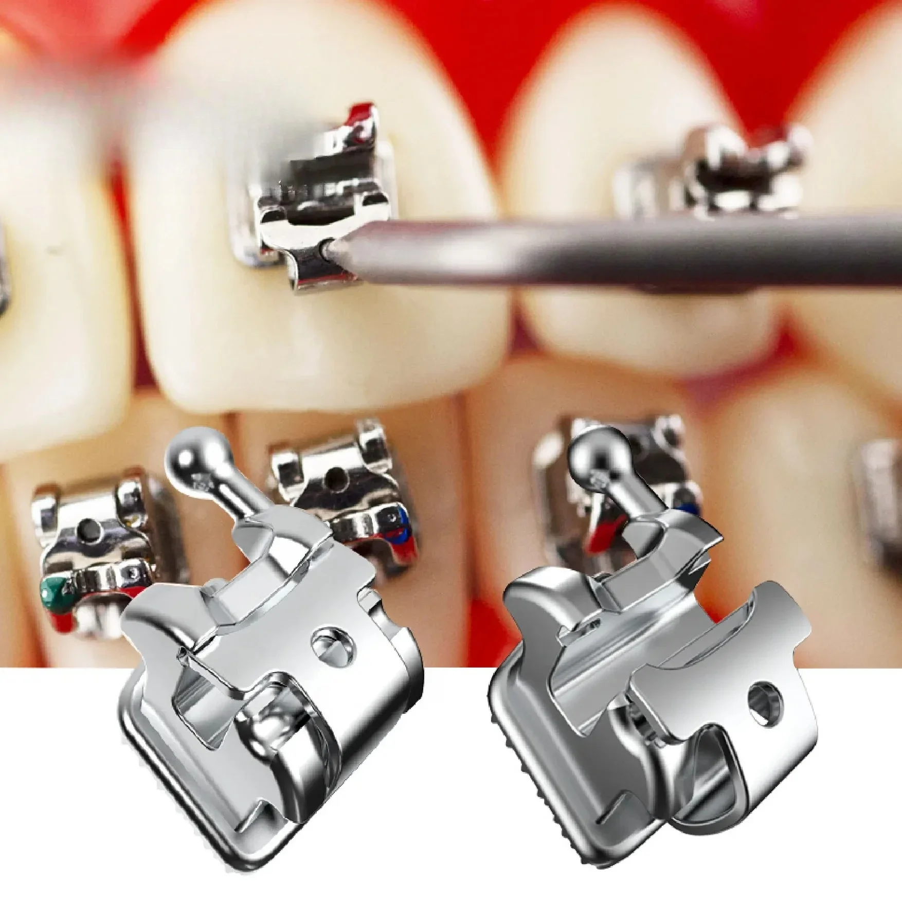 Self-orthopedic dentistry Mini dentin Automatic oligolification metal brackets Self-ligation brackets Orthodontic tooth