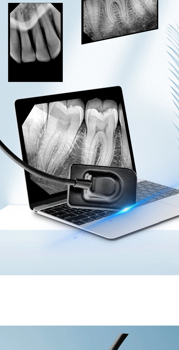Professioneller Dental-Röntgensensor - Radiovisiograph-Bildgebungssystem - Hochfrequenz-Intraorale Filmarbeit & Kamera-Zahnmedizinische Ausrüstung – Detail 3