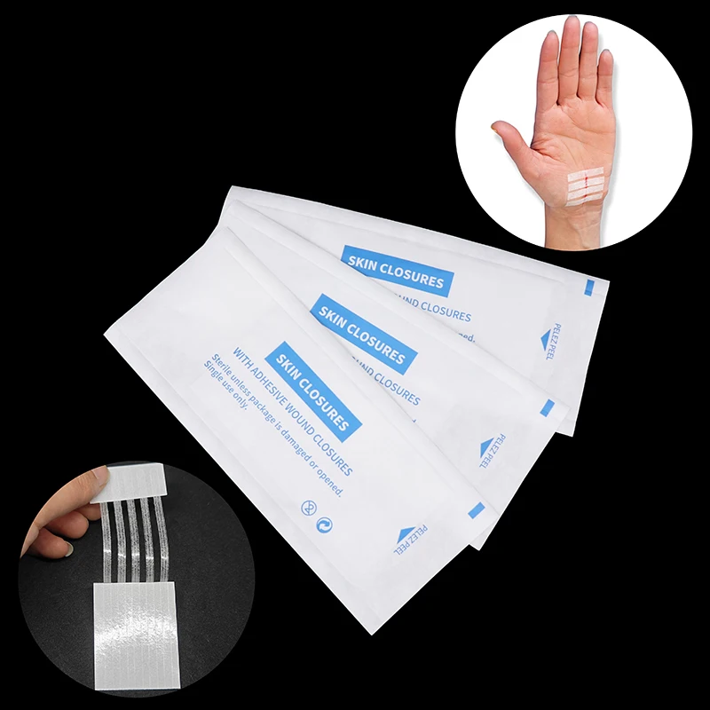 Sterile Strip Scar Away Acne Scar Marks Remover Sterile First Aid Travel Wound Skin Closures Medical Surgical Adhesive