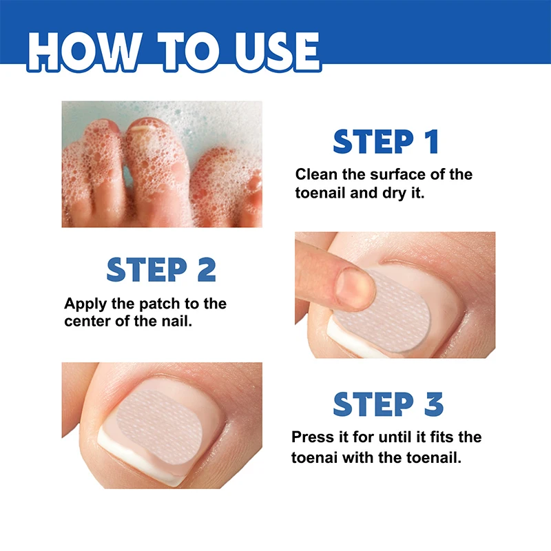 10ชิ้นสติกเกอร์แก้ไขเล็บเล็บเท้าคุด Onychomycosis ซ่อมแซมแพทช์ paronychia รักษากู้คืนเครื่องมือทำเล็บเท้า