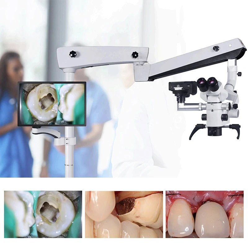 Microscopio dentale per apparecchiature mediche SCM600 con microscopio binoculare operativo chirurgico con fotocamera