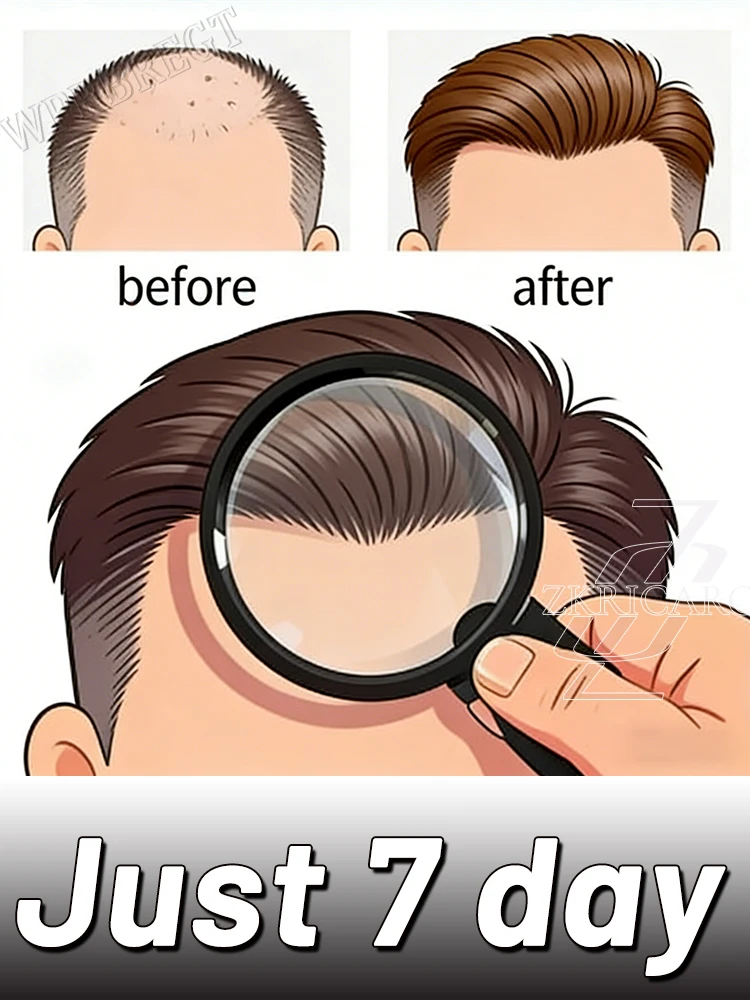 Upgṛaded ħaír root care 0íḷ, effectíve in 7 days, thick haír, thíck ħaír roots, Save Your Haír