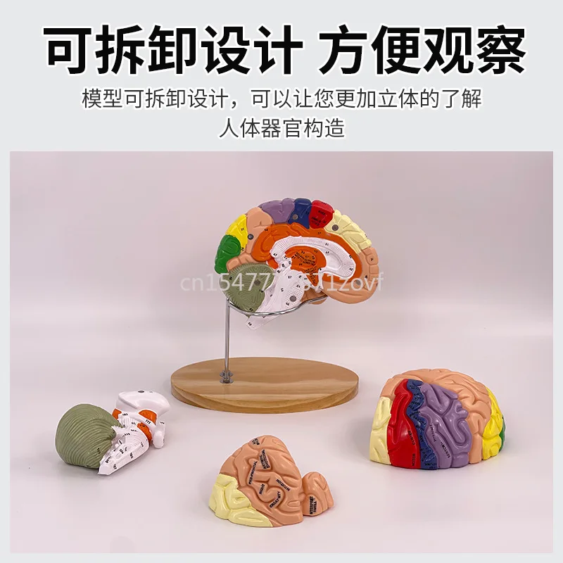 2 Times Magnification 4 Parts Brain Attached Cerebral Artery Model Cerebrovascular Model Neurology Human Brain Anatomy Model