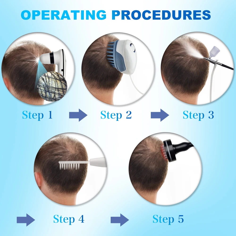 5 in 1 Scalp Skin Equipment Hair-scalp-analyzer Treatment Hair Growth Polarizado Hair Scalp Analyzer Machine