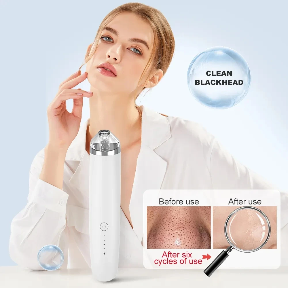 Electric Blackhead Removal Vacuum Acne Cleaner Facial Deep Cleansing USB Rechargeable Skin Care Tools