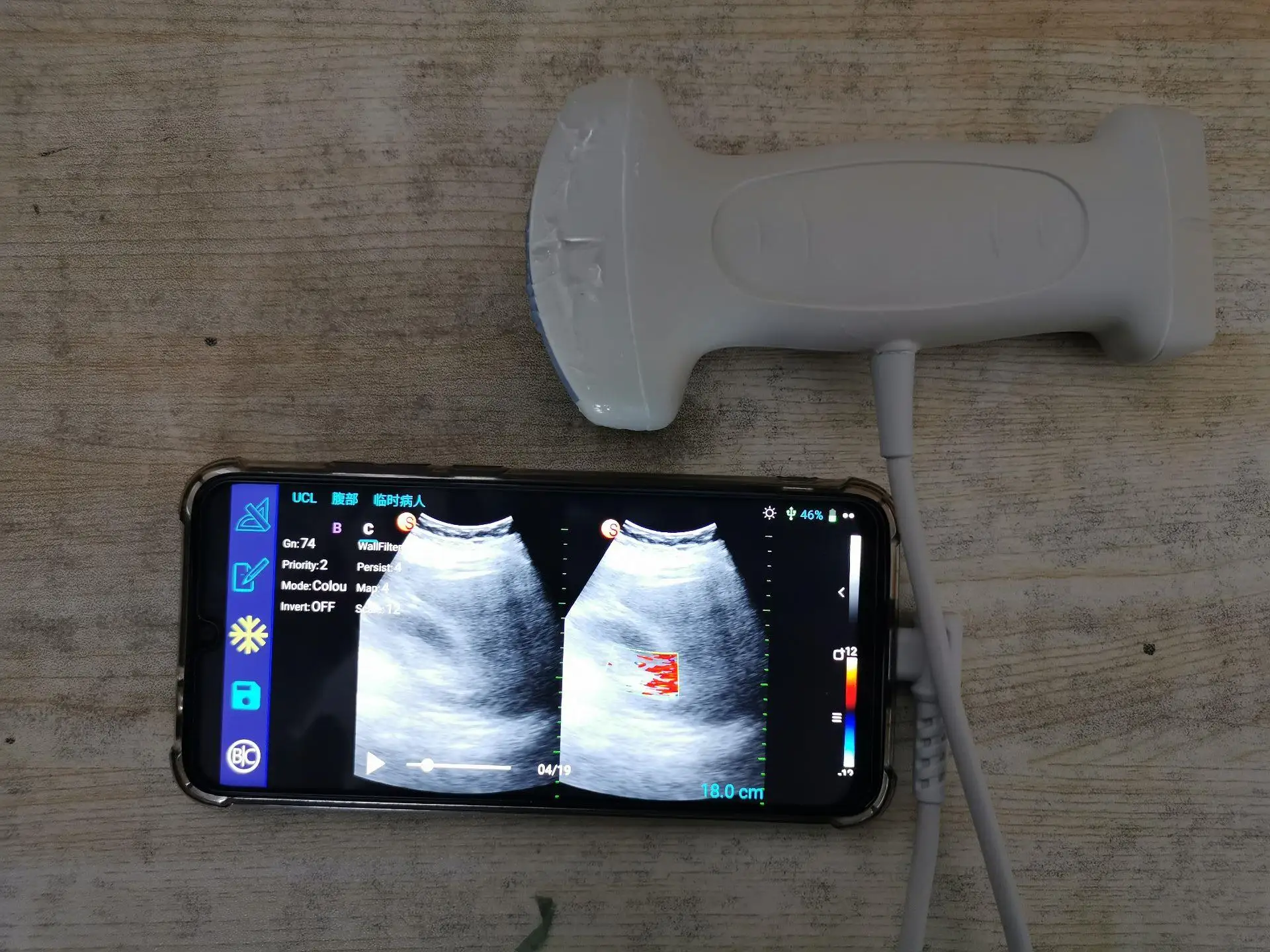 USB double head wireless ultrasound New Convex and Linear probe SUN-D3