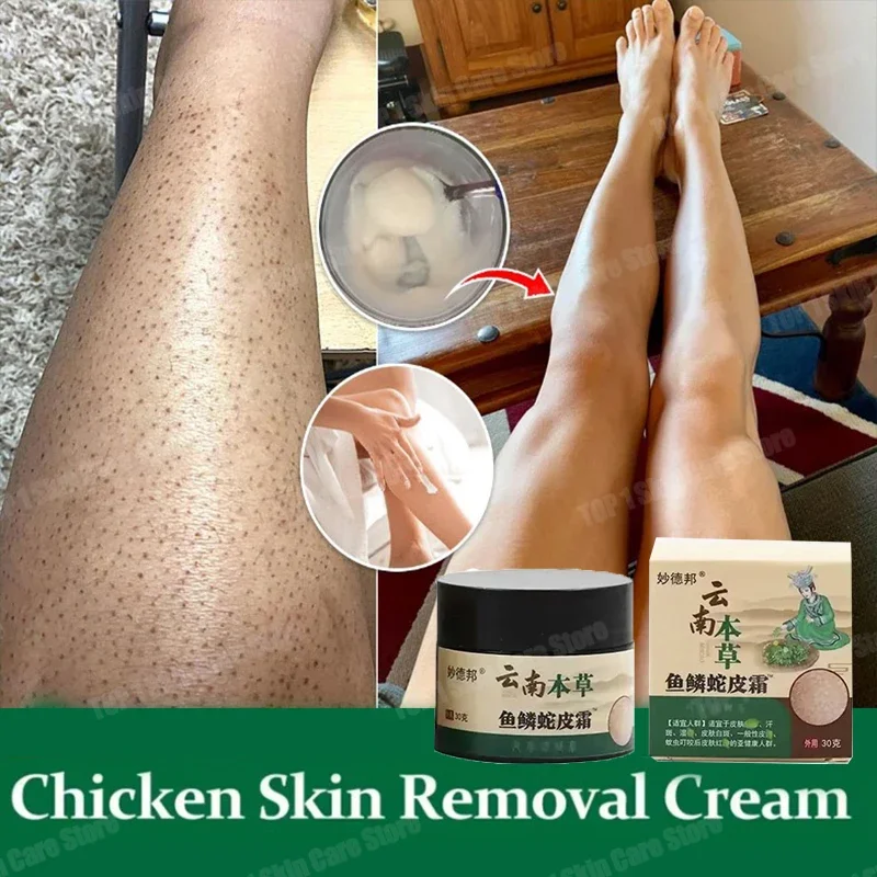 Chicken Skin Repair Cream Curing Keratosis Follicle Pilaris Body Dark Spot Remove Thick Pores Moisturizing Smooth Essence