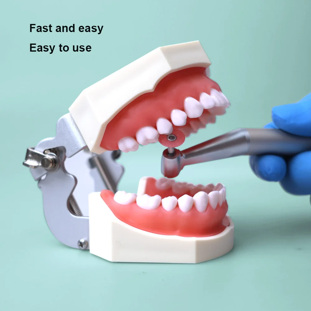 ELIJAH 40/80Pcs Dental Finishing and Polishing Discs Reduction Contouring Mandrel Ceramics and Glass Ionomer Restorations