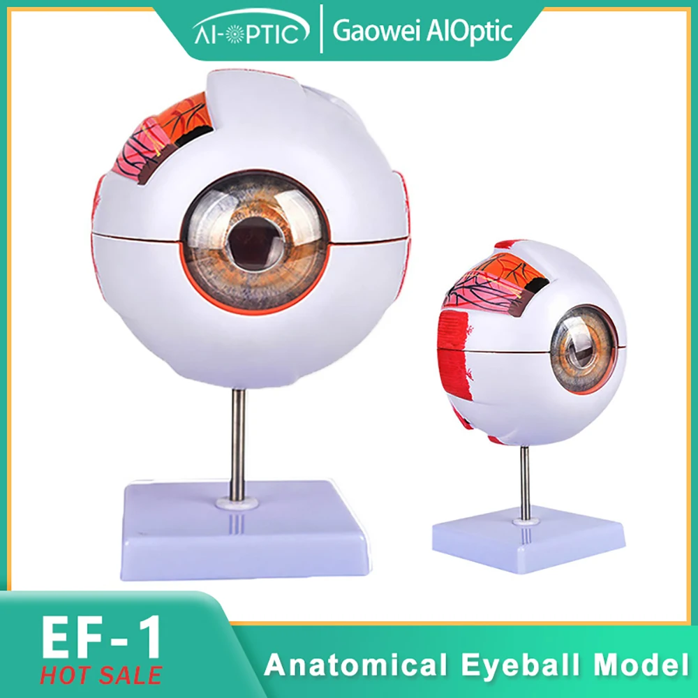 6X Enlarged Human Eye Anatomy Model, Eyeball Diseases Study, Teaching Demonstration Prop, Ophthalmology Learning Tool Optic