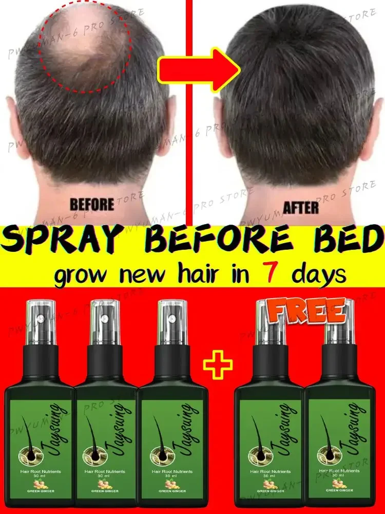 

Powerful Ginger Hair Growth Spray Hair Root Fast Grow Anti Hair Loss Essence Liquid Scalp Damaged Treatment Repair Beauty Health