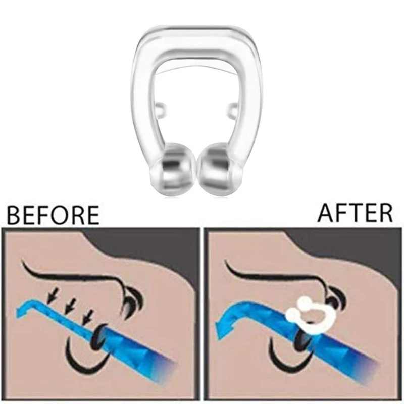 Portable Mini Anti Snoring Devices Nose Clips with Transparent for Case Dropship