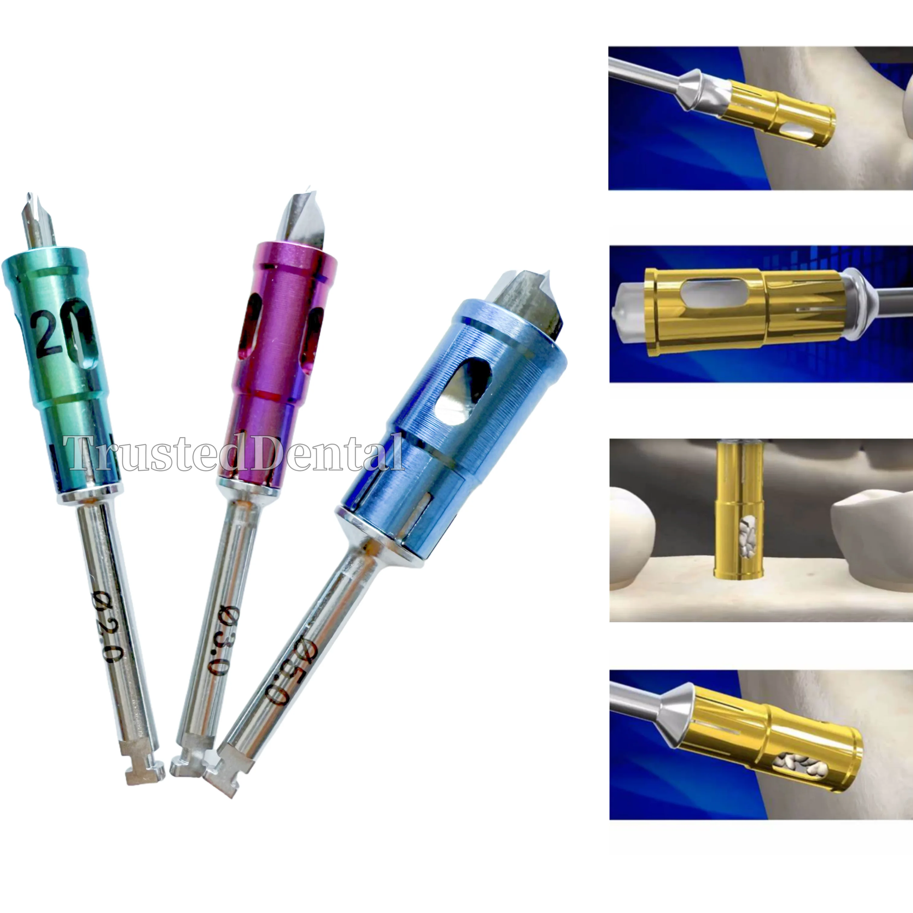 

Dental Self Bone Powder Harvest Never Loss Bone Collector Drills Implant Stopper