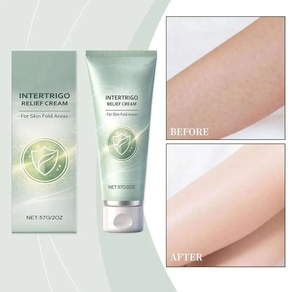 For Eliminate Discomfort Intertrigo Relief Cream Reduces Friction Keeps Creases Dry All Day Body Cream Quick-drying Body Care