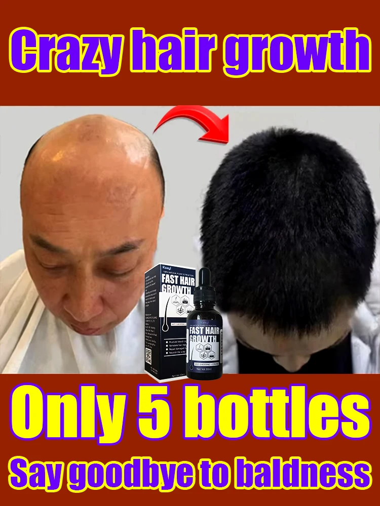 

Hot selling product, 99% of buyers buy again, have more and more hair, say goodbye to baldness, thick hair