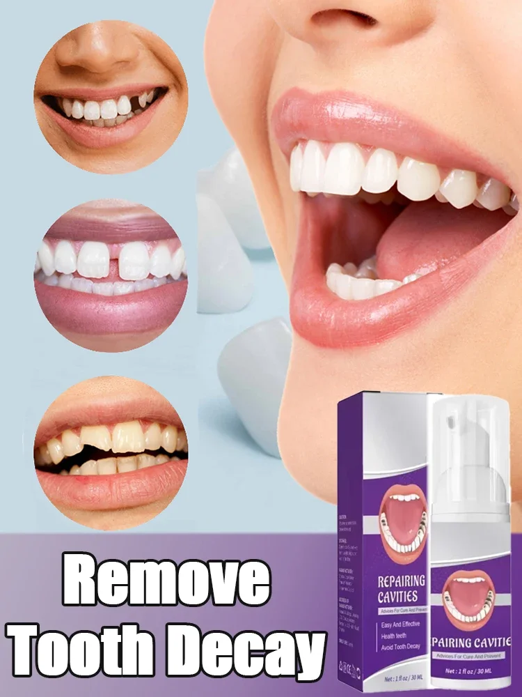 Effective Teeth Whitening Tooth decay repair  Calculus Plaque Periodontitis Remove Cavities