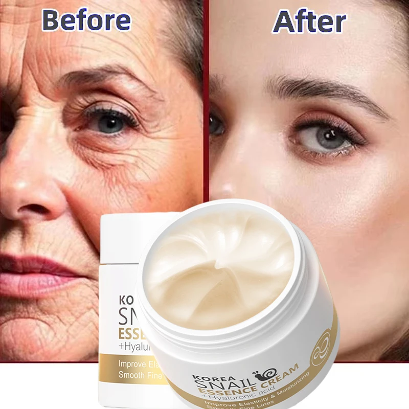 

Snail Essence Face Cream Effective Anti aging Wrinkle Removal Improve Dullness Hydration Moisturising Fade Fine Lines Skincare