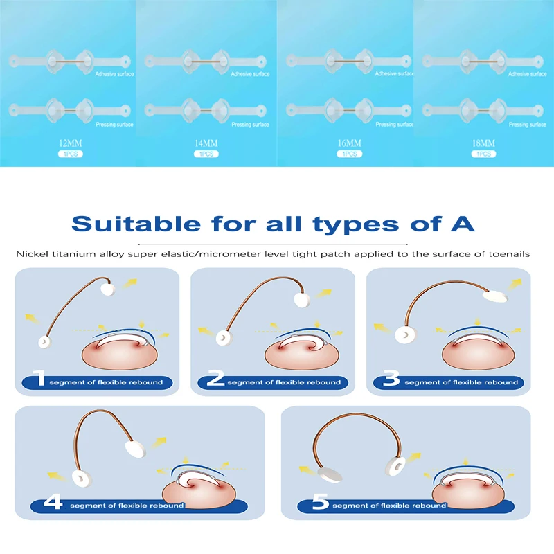 12/16/18mm Ingrown Toenail Corrector Tool Ingrown Toe Nail Treatment Elastic Patch Sticker Straightening Clip Brace PedicureTool