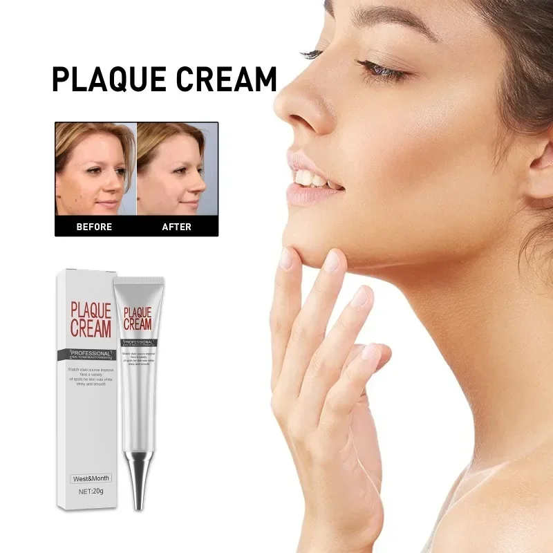 

Effective brightening Cream Fade Dark Spot Melanin Freckle Whitening Removal Melasma Lighten Anti-Aging facial Skin repair