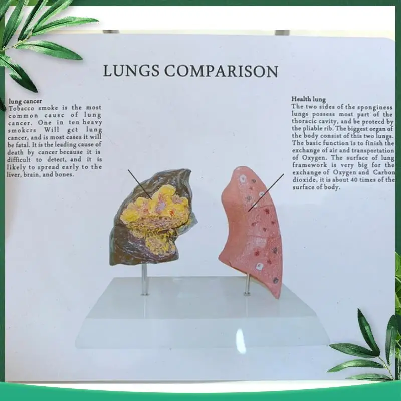 

(NEW) Smoker's Lung Model Healthy Lung Model With Pathological Respiratory System Disease Lungs