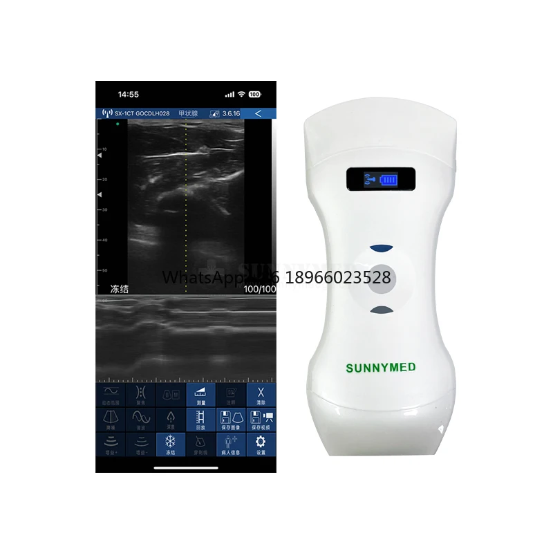 SY-AC51_CPL High Speed Clear Image Linear/Convex Probe Portable Ultrasound Wireless Wifi Handheld Ultrasound Scanner