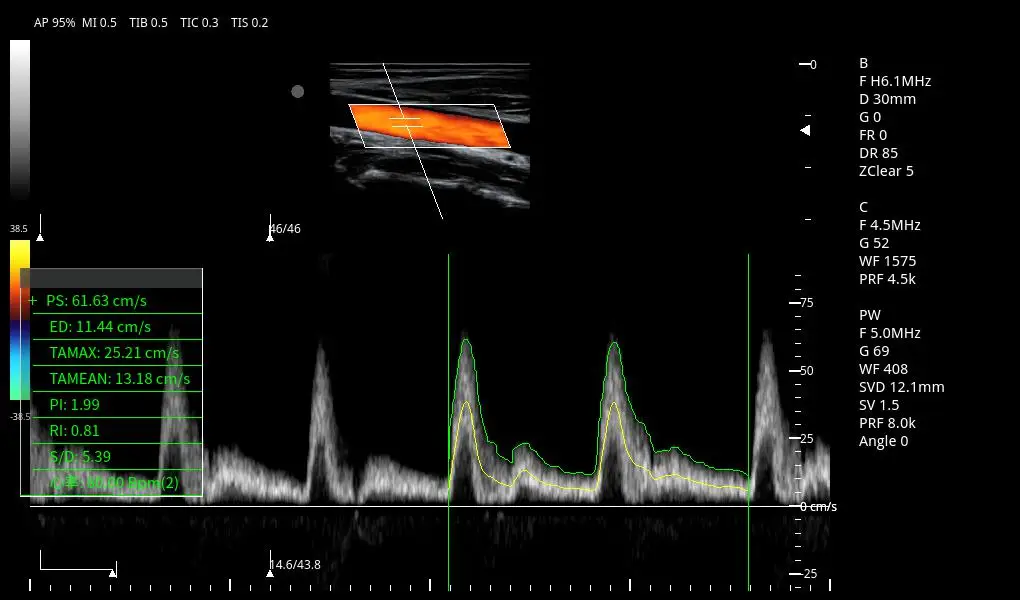 3D/4D Color Doppler Ultrasound System Cardiac Ultrasound Trolley Ultrasonic Diagnostic System Medical Ultrasound Instruments