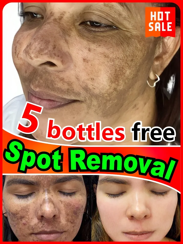 

100% safe and effective to solve your dark spots and pigmentation symptoms