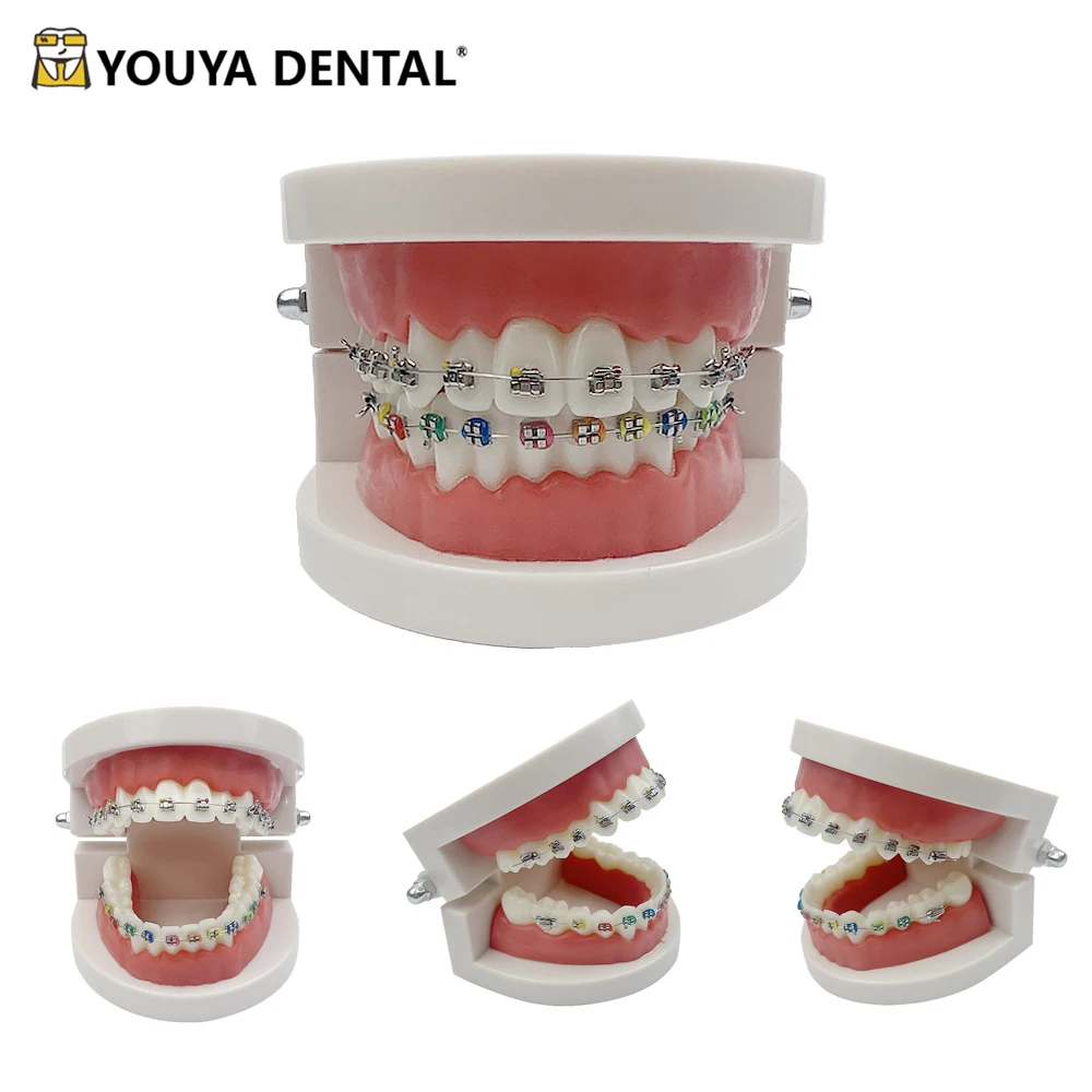 

Dental Model Orthodontic Teeth Practice Model For Dental Teeth Teaching Studying Model Doctor-patient Communication Tools