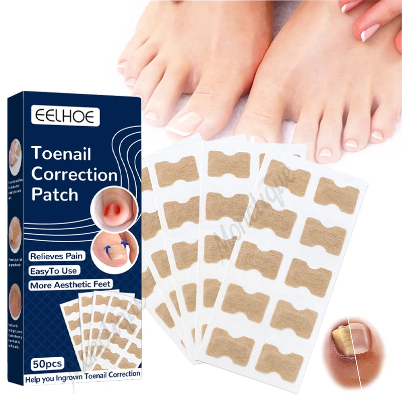 50/150PCS Orthopedic Patch Embedded Nails Gray Fungal Infection Thicken Discoloration Repair Patch Portable Nail Care Products