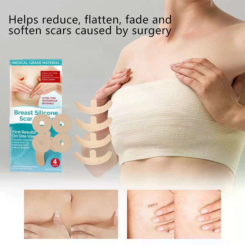 قابلة لإعادة الاستخدام هلام السيليكون ملصقات غير مرئية قوس دائري الصدر غير مرئية المخفي ندبة رقعة إصلاح الوشم عيب إخفاء الشريط #2