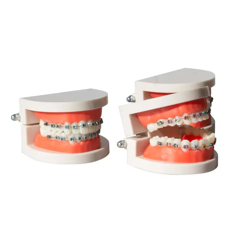 Oral Metal Bracket Model, Outpatient Doctor-Patient Communication Display, Dental Model, Bracket Model