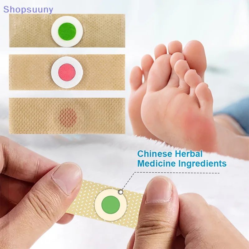 Sneaker Care Products - [SU]6/12/18/24/30/36Pcs Foot Corn-Callus Removal Clavus Paster