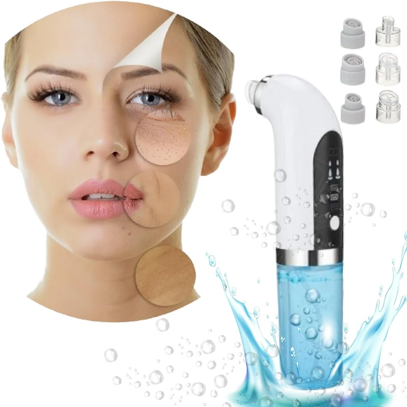 Gezicht Neus Porie Schoner Extractor Acne Behandeling Mee-eter Remover Vacuüm Machine Porie Krimpen Zwarte Kop Removal Tool