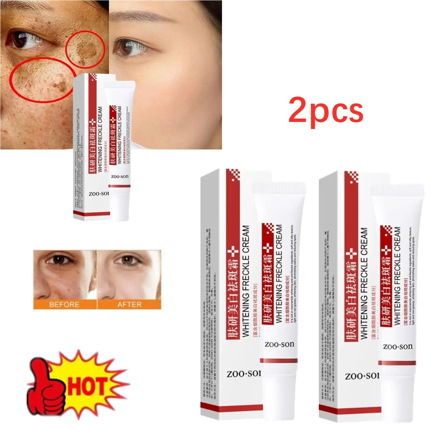 

2X Effective Whitening Freckle Cream Remove Dark Spots Anti Freckle Cream Fade Pigmentation Melasma Brighten Creams Skin Care