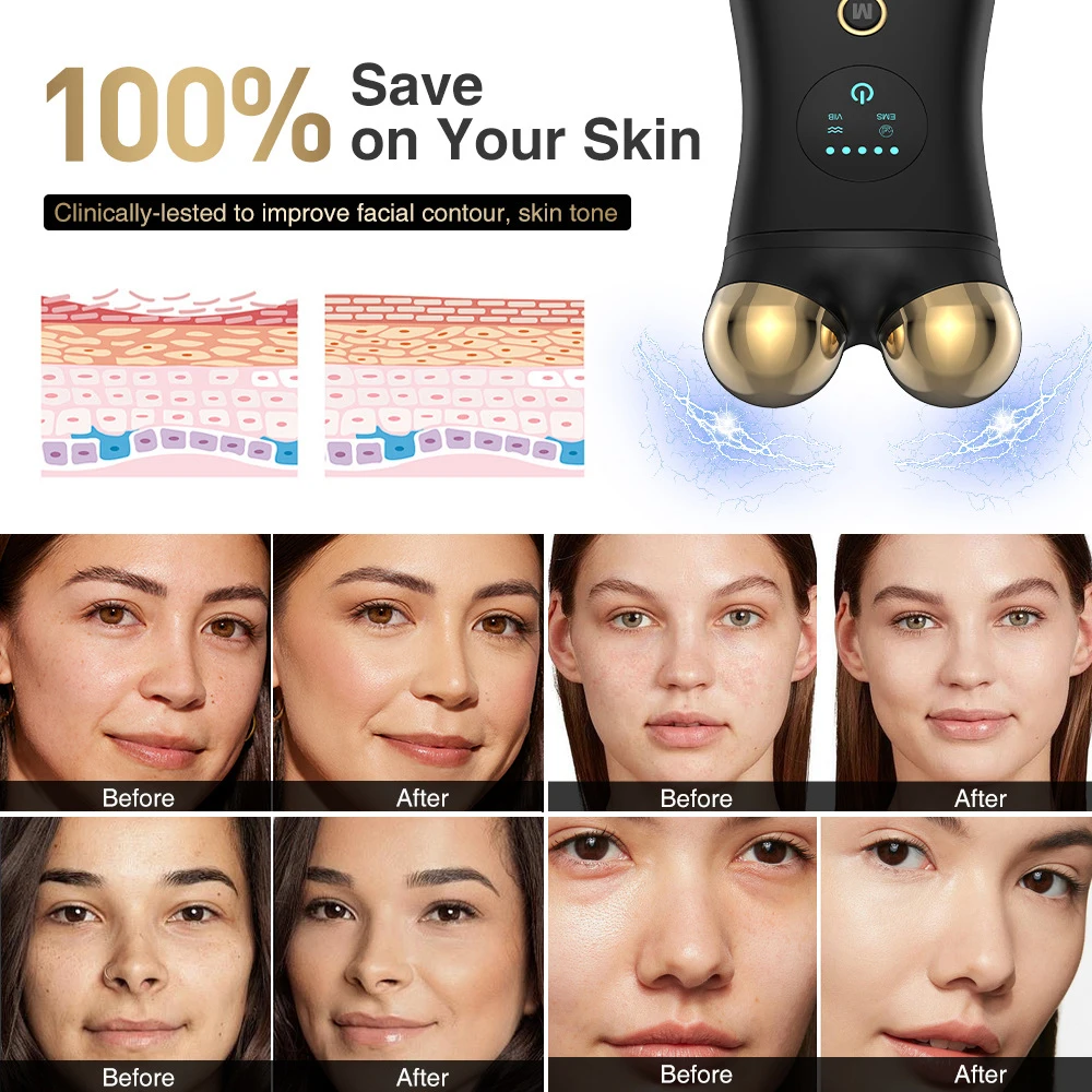 Masajeador Facial de microcorriente EMS, máquina de Estiramiento Facial, rodillo para estiramiento de la piel, rejuvenecimiento Facial, terapia de luz roja antiarrugas