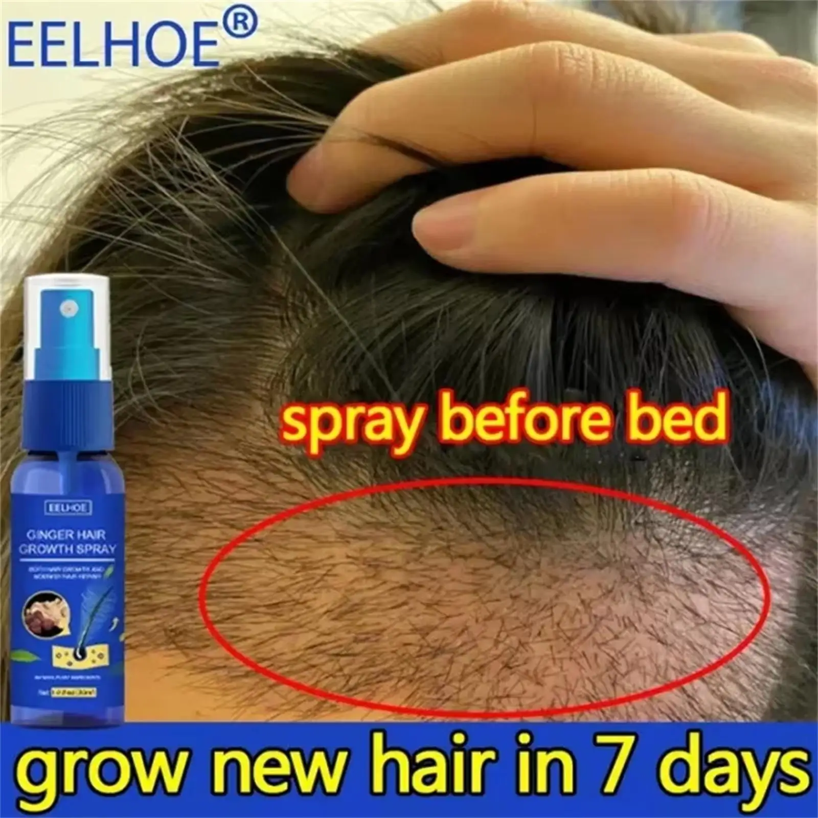 

Hair Growth Spray Promote Fast Thicker Longer Ginger Extract Prevent Baldness Moisturize Scalp Anti Hair Loss Beauty Health