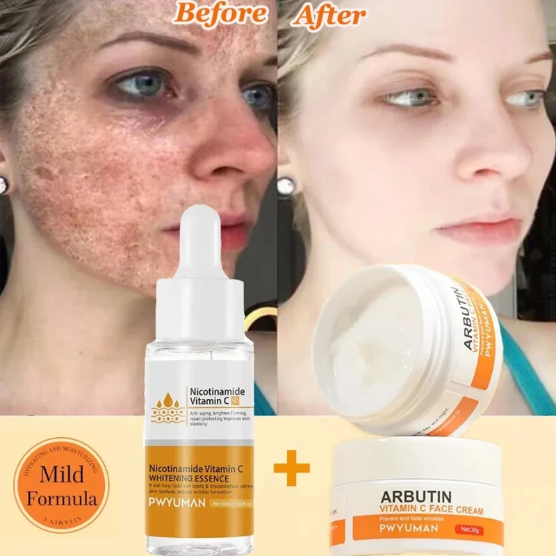 

Vitamin C Whitening Freckles Serum Cream Remove Dark Spots Melasma Niacinamide Lighten Melanin Acne Scars Anti-aging Skin Care