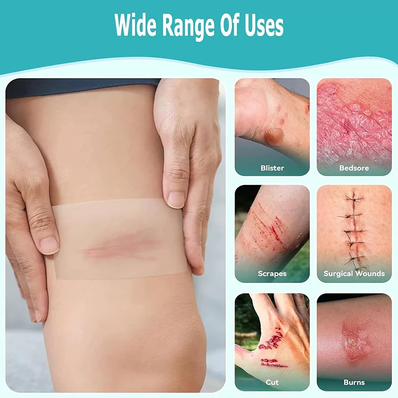 ضمادة الغروانية المائية لفة ذاتية اللصق تضميد الجروح لبثور قرحة الضغط عالية الامتصاص الرعاية الطبية وسادة شفاء الجلد