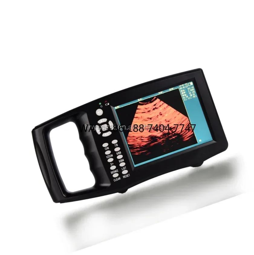 medical supplies Medical ultrasound machine veterinary portable ultrasound scanner color ultrasound machine hot sale good price