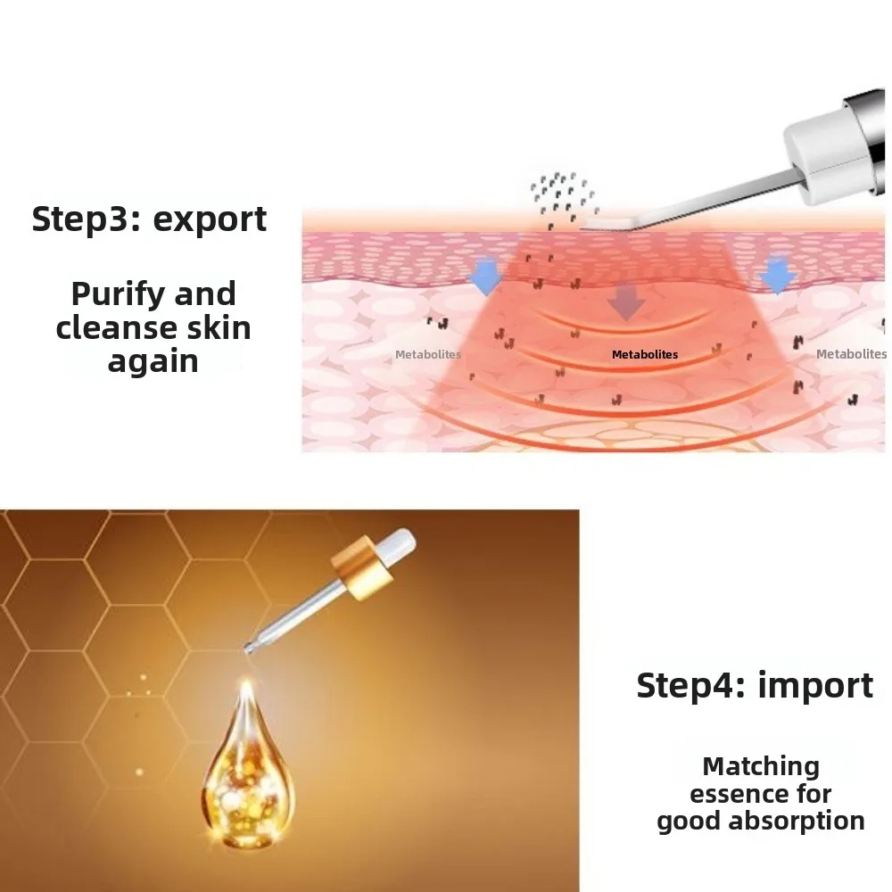 جهاز تنظيف البشرة بالموجات فوق الصوتية عميق الاهتزاز بالموجات فوق الصوتية أيون قابل لإعادة الشحن مزيل الرؤوس السوداء منظف المسام الاحترافي للعناية بالوجه #4