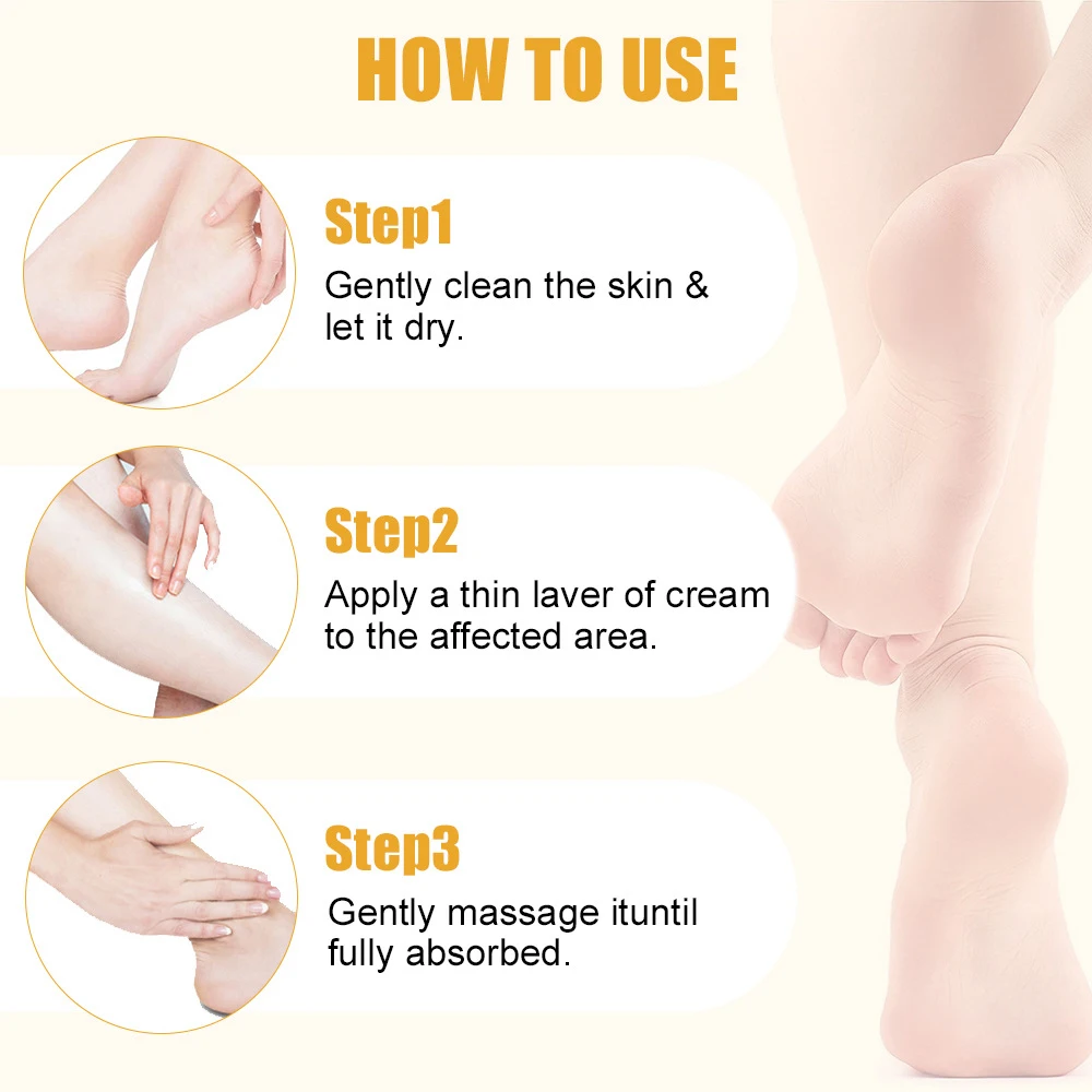 40g ยูเรียครีมเท้าแห้ง Cracked Feet Heel ขัดผิวอ่อนโยนนุ่ม Ultra-Hydrating Hand Foot Care ครีม Stick Protuct