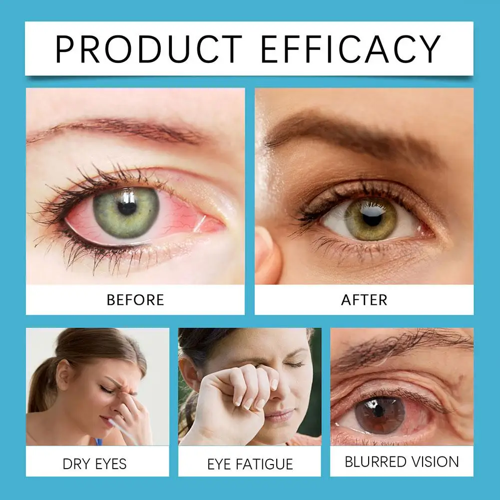 

10/5/3/1pcs Relief Eye Drops Improve Vision Eye Care Liquid Myopia Fatigue Dry Itching Clean Better Vision Eye Health Care