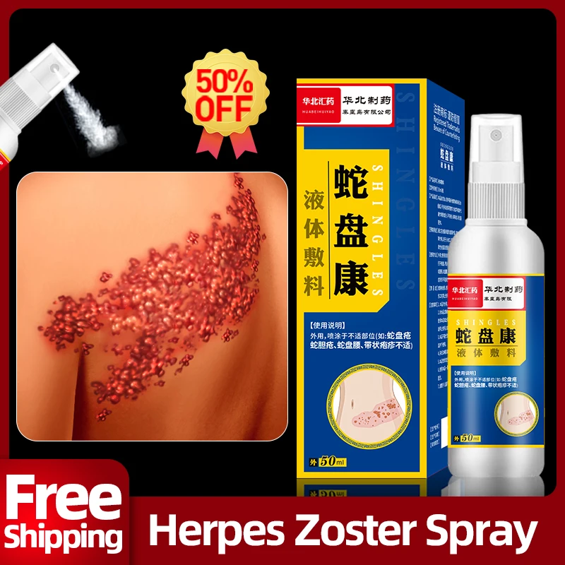 Tratamiento de Herpes Zoster en espray para eliminar el Herpes simple, eliminador de piel para el dolor de serpiente, puntos rojos, crema medicinal CFDA