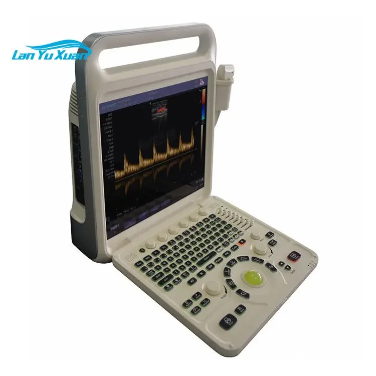 Wholesale E60 Full Digital Color Doppler System Suppliers Therapeutic Portable Ultrasound Equipment