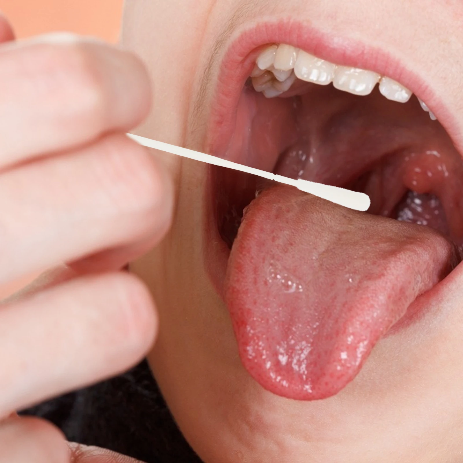 20 個喉綿棒サンプリングスティックシングルエンド口咽頭植毛口腔標本収集綿棒使い捨てクリニック