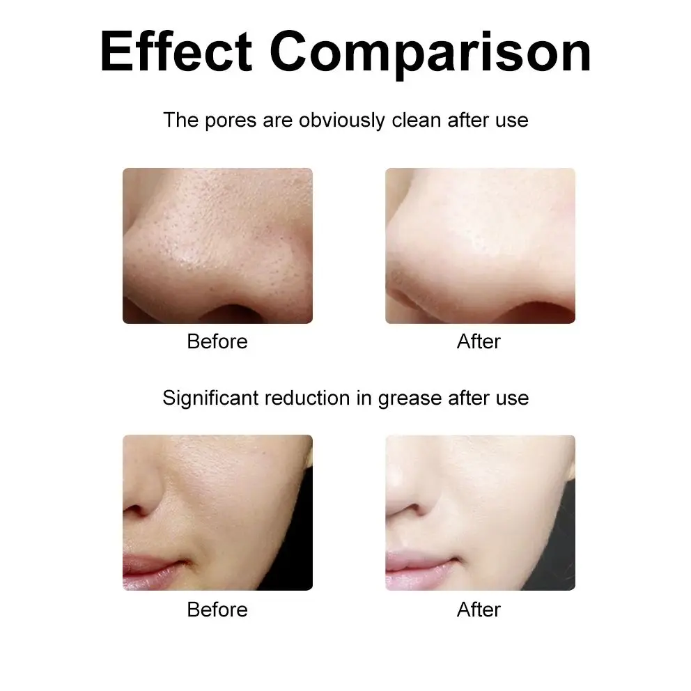 Professionele Ultrasone Huid Scrubber Diepe Gezicht Reiniging Verwijdert Granen En Puistjes Verjonging Peeling Schoonheidsverzorging Machine