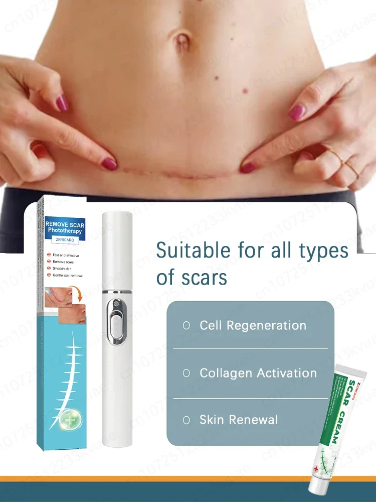 Scars? Knife scars? Surgery scars? Tattoo scars? Burn scars? Fall scars? Quick recovery in 7 days