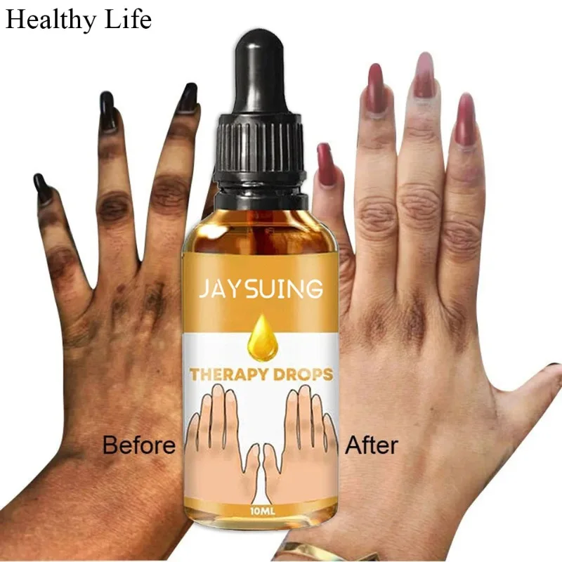 

Dark Knuckles Fast Whitening Serum Black Skin Pigmentation Correctors Hand Knuckle Elbows Knee Intense Stains Remover Essence