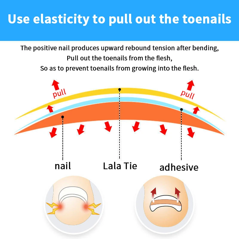 10PCS Trattamento delle unghie dei piedi incarnite Strumento di correzione dell'unghia del piede incarnita Adesivo patch elastico Raddrizzamento Clip Brace Strumenti per pedicure